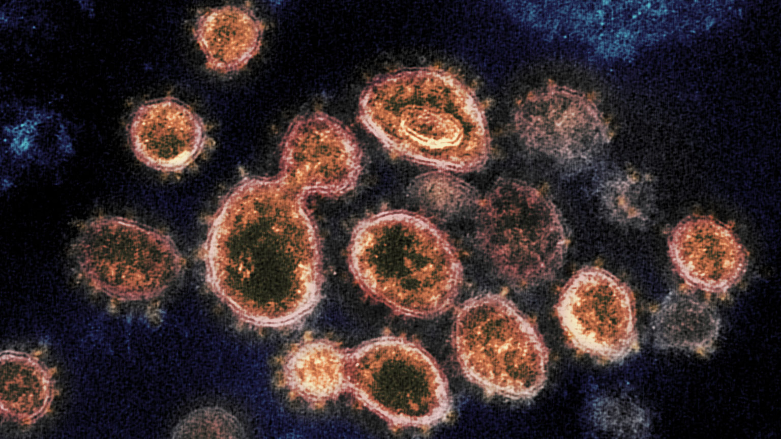 This transmission electron microscope image shows SARS-CoV-2, the virus that causes COVID-19, isolated from a patient in the U.S. Virus particles are shown emerging from the surface of cells cultured in the lab. The spikes on the outer edge of the virus particles give coronaviruses their name, crown-like. (Couresty: NIAID-RML)