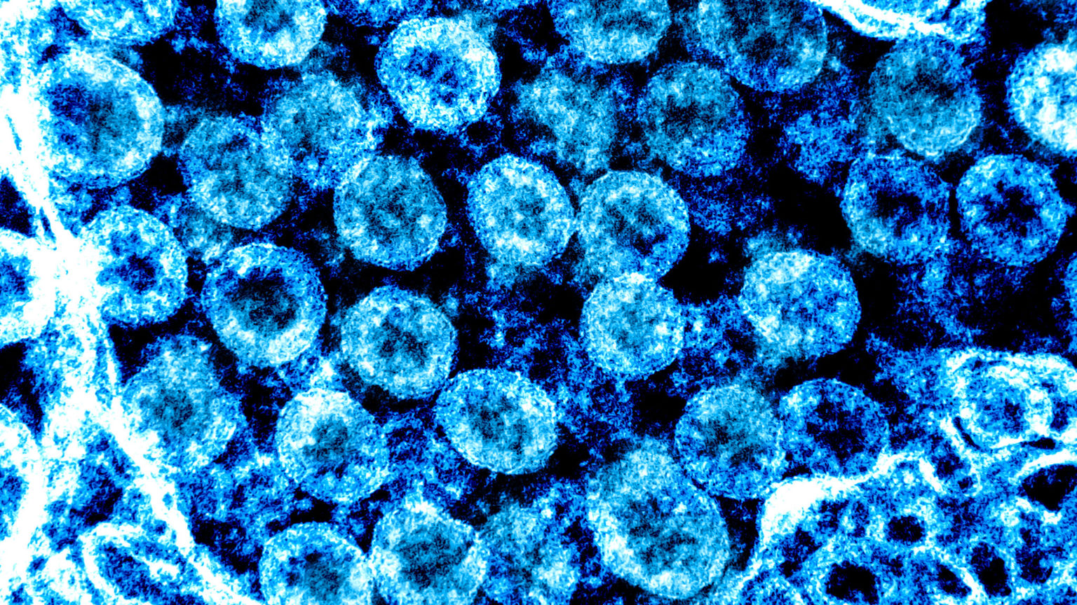 microscopic photo illustration of Coronavirus