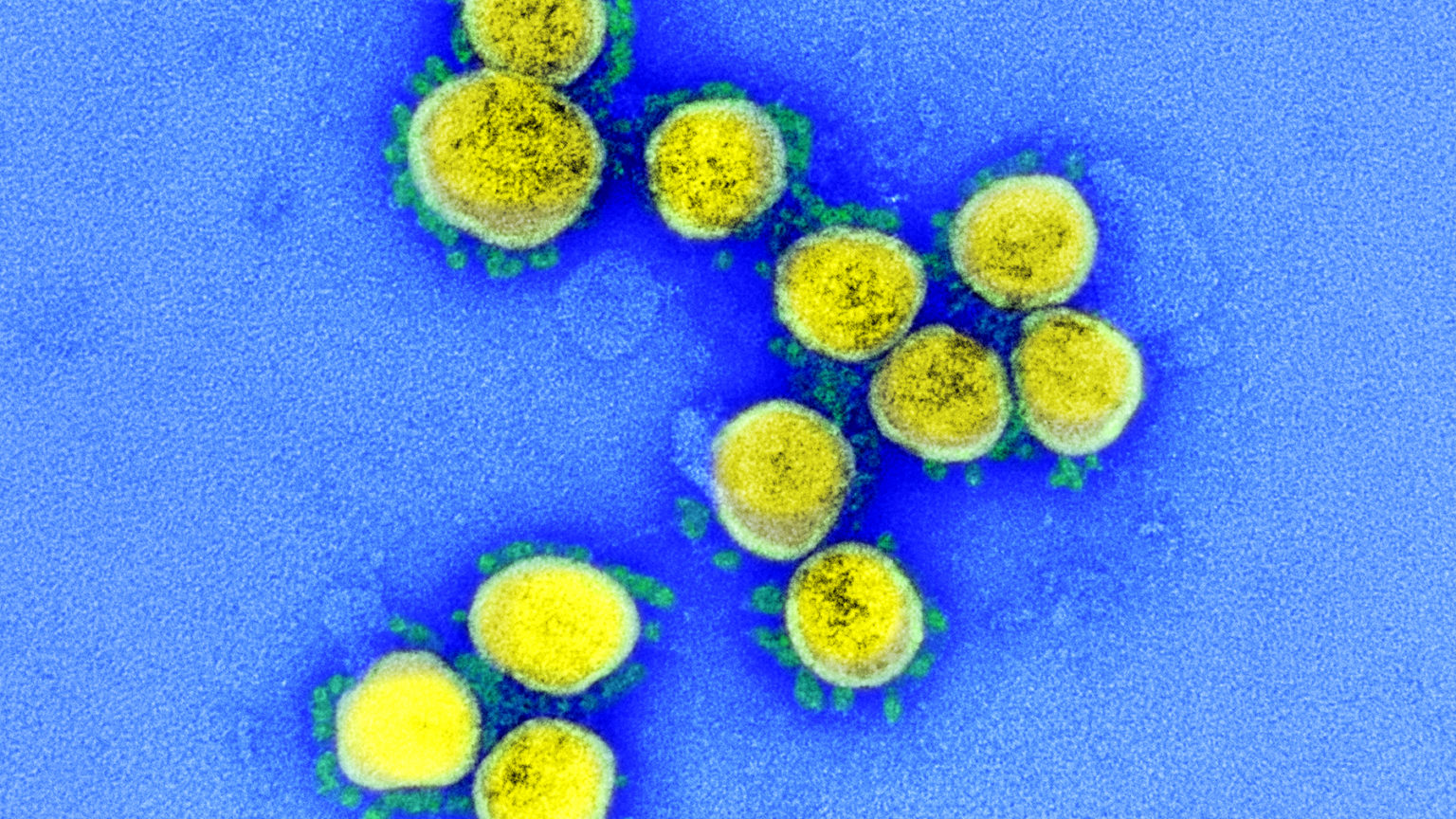 Microscopic image of virus