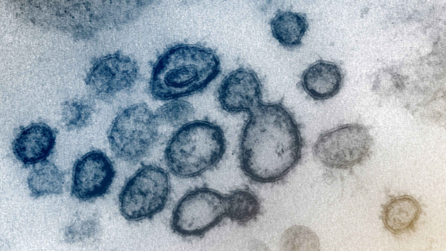 This transmission electron microscope image shows SARS-CoV-2—also known as 2019-nCoV, the virus that causes COVID-19—isolated from a patient in the U.S. Virus particles are shown emerging from the surface of cells cultured in the lab. The spikes on the outer edge of the virus particles give coronaviruses their name, crown-like.Image captured and colorized at NIAID's Rocky Mountain Laboratories (RML) in Hamilton, Montana. (Courtesy: NIAID)