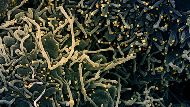 Colorized scanning electron micrograph of a VERO E6 cell (blue-green) exhibiting elongated cell projections and signs of apoptosis, after infection with SARS-COV-2 virus particles (yellow), which were isolated from a patient sample. Image captured at the NIAID Integrated Research Facility (IRF) in Fort Detrick, Maryland. (Courtesy: NIAID)