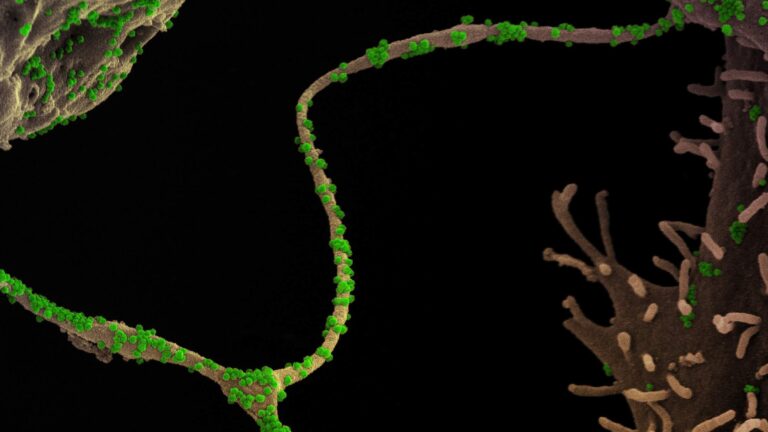 SARS-CoV-2 virus