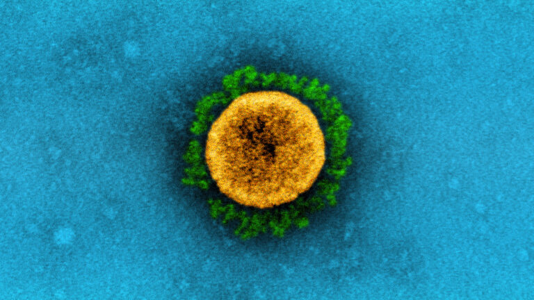 A transmission electron micrograph of a SARS-CoV-2 virus particle B.1.1.7 variant with the virus particle highlighted in yellow and its spike proteins in green against a blue background.