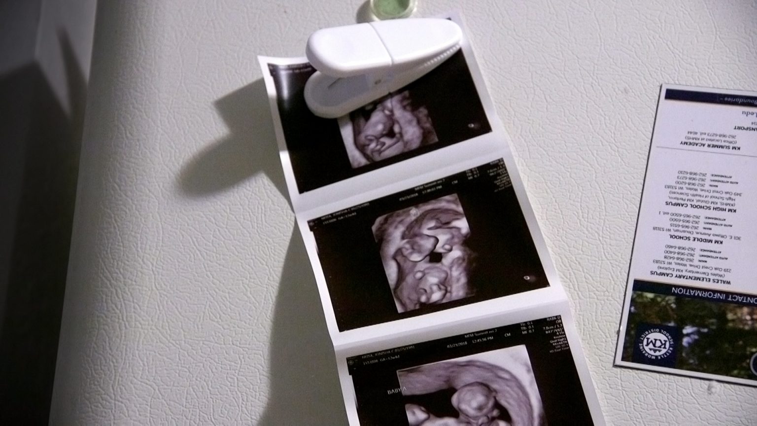 sonogram photos hanging on refrigerator