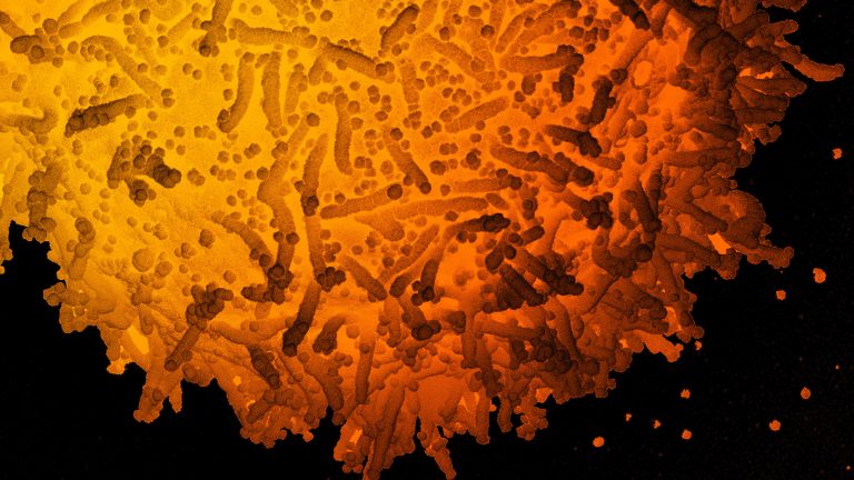 Electronic micrope image of novel coronavirus particles covering an infected cell