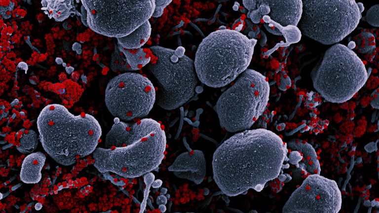 Human cells (in gray) infected and covered with SARS-CoV-2 virus particles (in red)