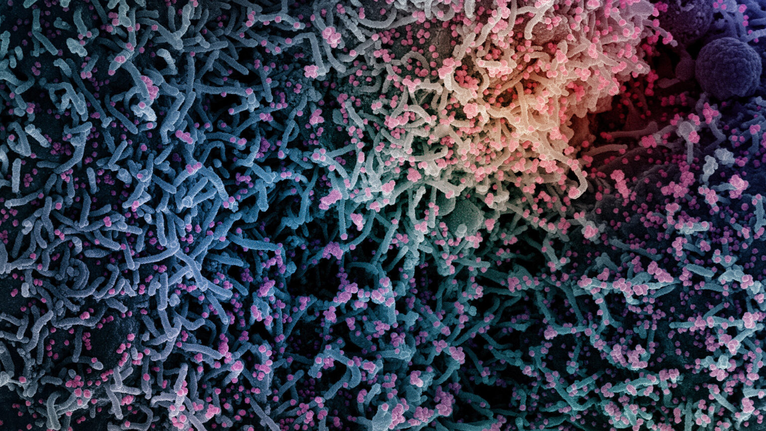 An electron micrograph that is colorized shows a cell infected with a variant strain of SARS-CoV-2 virus particles.