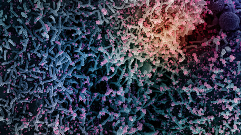 An electron micrograph that is colorized shows a cell infected with a variant strain of SARS-CoV-2 virus particles.