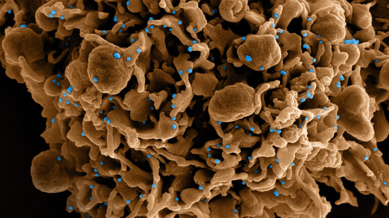 An electron micrograph highlights COVID-19 viroids on a cellular surface.