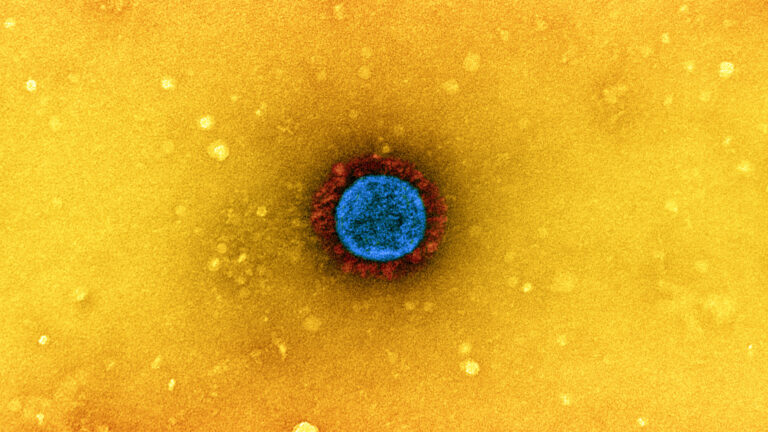 A colorized electron micrograph image shows a SARS-CoV-2 virus particle. 